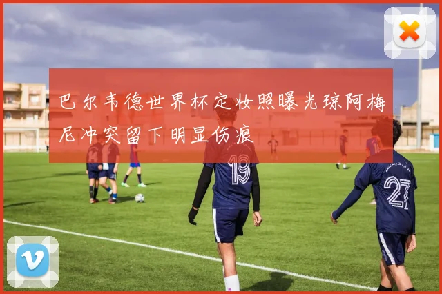巴尔韦德世界杯定妆照曝光琼阿梅尼冲突留下明显伤痕